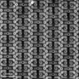 Mastering Semiconductor Defect Localization with Passive Voltage Contrast