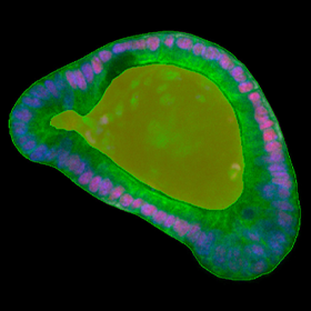 How to easily segment outer organoid cell layers