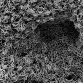 HAnano Surface-treated PEEK implant